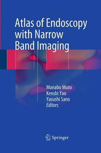 Atlas of Endoscopy with Narrow Band Imaging - Manabu Muto