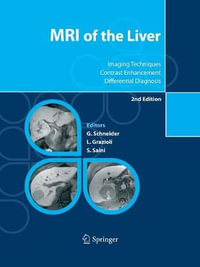 MRI of the Liver : Imaging Techniques, Contrast Enhancement, Differential Diagnosis - GÃ¼nther Schneider