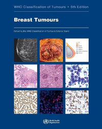 WHO Classification of Breast Tumours : WHO Classification of Tumours, Volume 2 - S.R. Lakhani