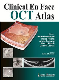 Clinical En Face OCT Atlas - Bruno Lumbroso