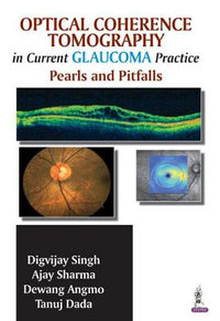 Optical Coherence Tomography in Current Glaucoma Practice : Pearls and Pitfalls - Digvijay Singh