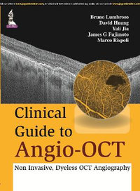 Clinical Guide to Angio-OCT : Non Invasive, Dyeless OCT Angiography - Bruno Lumbroso