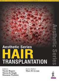 Aesthetic Series - Hair Transplantation : Aesthetic - Marc R Avram