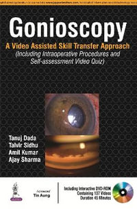 Gonioscopy : A Video Assisted Skill Transfer Approach - Tanuj Dada