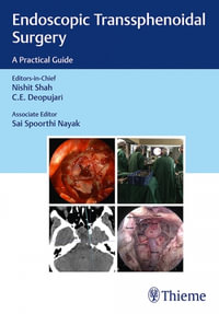 Endoscopic Transsphenoidal Surgery : A Practical Guide - Nishit Shah