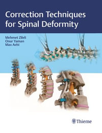 Correction Techniques for Spinal Deformity - Mehmet Zileli
