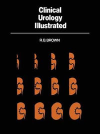 Clinical Urology Illustrated - R. B. Brown