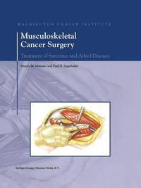 Musculoskeletal Cancer Surgery : Treatment of Sarcomas and Allied Diseases - Martin M. Malawer