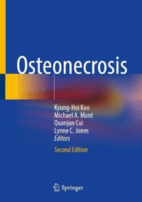 Osteonecrosis - Kyung-Hoi Koo