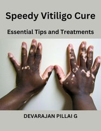 Speedy Vitiligo Cure : Essential Tips and Treatments - DEVARAJAN PILLAI G