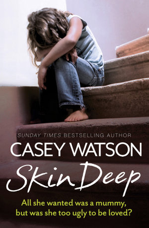 Skin Deep : All She Wanted Was a Mummy, But Was She Too Ugly to Be Loved? - Casey Watson