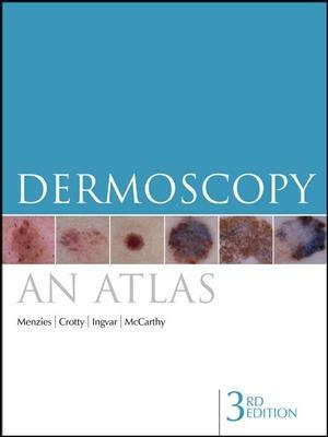 Dermoscopy : An Atlas : 3rd Edition - Scott W. Menzies