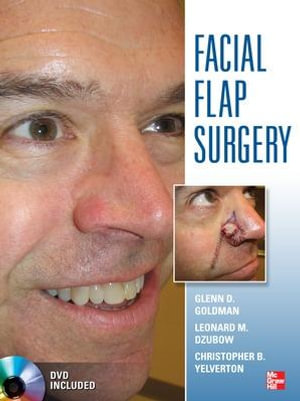 Facial Flaps Surgery - Glenn Goldman