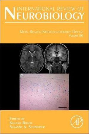 International Review of Neurobiology Vol 110 : Volume 110 - Kailash P Bhatia