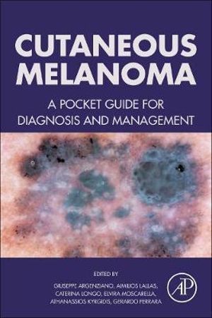 Cutaneous Melanoma : A Pocket Guide for Diagnosis and Management - Giuseppe Argenziano