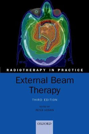 External Beam Therapy : 3rd edition - Peter Hoskin