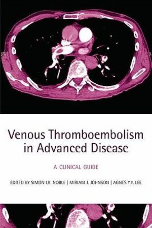 Venous Thromboembolism in Advanced Disease : A Clinical Guide - Simon I R Noble