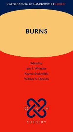 Burns (OSH Surgery) : Oxford Specialist Handbooks in Surgery - Iain S. Whitaker