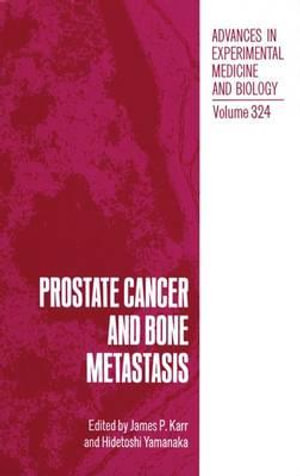 Prostate Cancer and Bone Metastasis : Environmental Science Research - James P. Karr