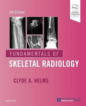 Fundamentals of Skeletal Radiology : 5th Edition - Clyde A. Helms