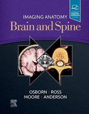 Imaging Anatomy Brain and Spine - Anne G. Osborn