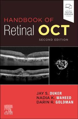 Handbook of Retinal OCT 2ed : Optical Coherence Tomography - Jay S. Duker