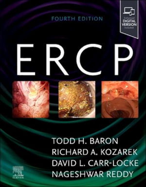 ERCP - Baron