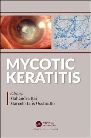 Mycotic Keratitis - Mahendra Rai