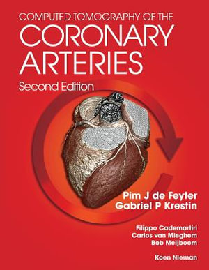 Computed Tomography of the Coronary Arteries - Pim J. de Feyter