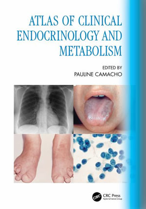 Atlas of Clinical Endocrinology and Metabolism - Pauline Camacho