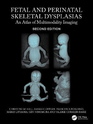 Fetal and Perinatal Skeletal Dysplasias : An Atlas of Multimodality Imaging - Christine M Hall