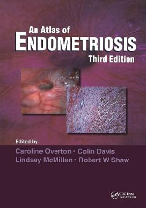 Atlas of Endometriosis : Encyclopedia of Visual Medicine Series - Caroline Overton