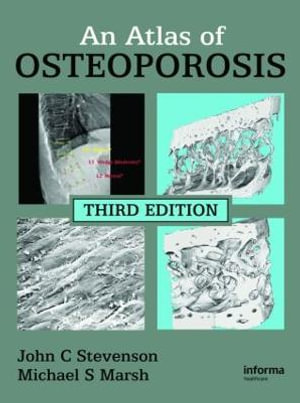 An Atlas of Osteoporosis : Encyclopedia of Visual Medicine Series - John C. Stevenson