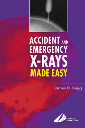 Accident and Emergency X-rays Made Easy : Made Easy - James D. Begg