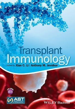 Transplant Immunology - Xian C. Li