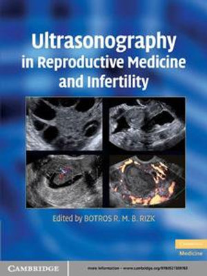 Ultrasonography in Reproductive Medicine and Infertility - Botros R. M. B. Rizk