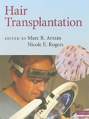 Hair Transplantation : Cambridge Medicine (Hardcover) - Marc Avram