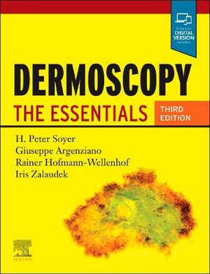 Dermoscopy 3e : The Essentials - H. Peter Soyer