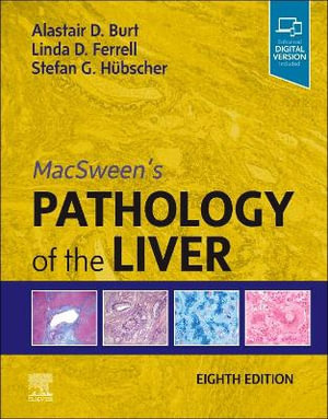 MacSween's Pathology of the Liver - Ferrel