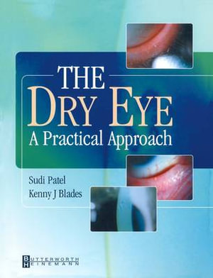 Dry Eye : A Practical Approach - Kenny Blades