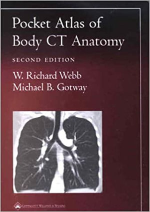 Pocket Atlas of Body CT Anatomy : Radiology Pocket Atlas - Webb Gotway