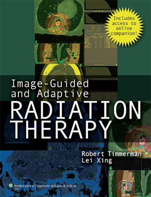 Image-Guided and Adaptive Radiation Therapy - Timmerman Xing