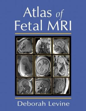 Atlas of Fetal MRI - Deborah Levine