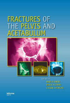 Fractures of the Pelvis and Acetabulum - Wade R. Smith