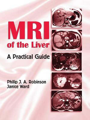 MRI of the Liver : A Practical Guide - Philip J. A. Robinson