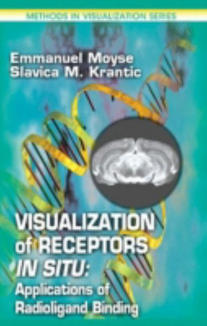 Visualization of Receptors in Situ : Applications of Radioligand Binding - Emmanuel Moyse