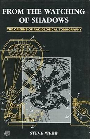 From the Watching of Shadows : The Origins of Radiological Tomography - Steve Webb