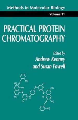 Practical Protein Chromatography : Practical Protein Chromatography 11 - Andrew Kenney