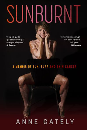 SUNBURNT : A memoir of sun, surf and skin cancer - Anne C Gately