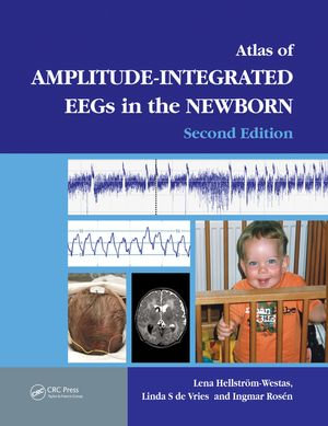 An Atlas of Amplitude-Integrated EEGs in the Newborn - Lena Hellström-Westas